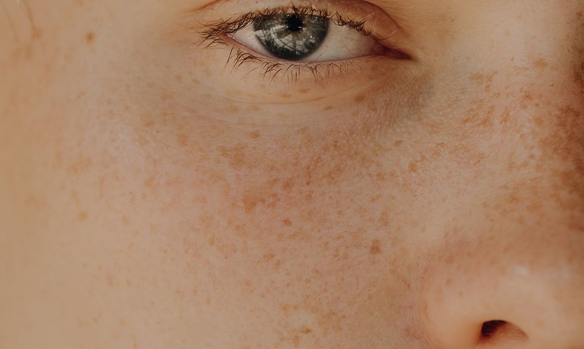 La higiene es facial es uno de los tres pilares para construir una piel bonita, junto al cuidado de tus cremas y la fotoprotección solar.